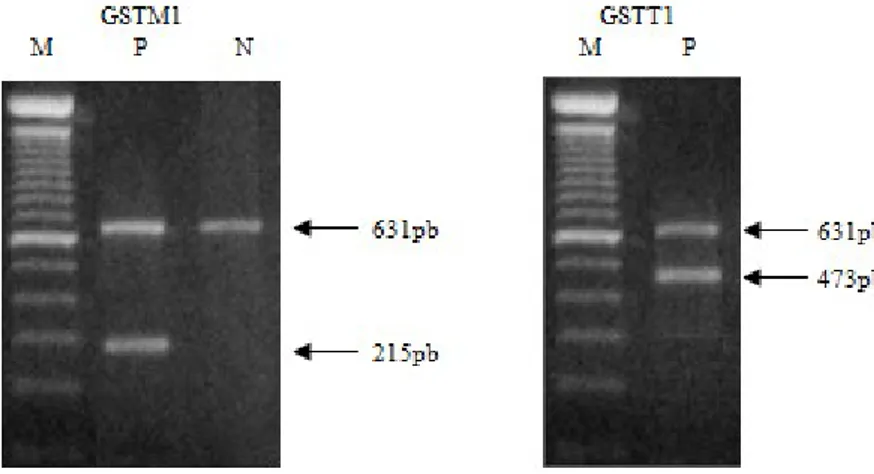 Figura 7 - Imagens do gel de agarose quando se incide a luz UV para análise do genótipo