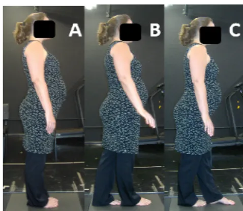 Figura  2.  Posturas  avaliadas  sobre  a  plataforma  de  força.  A:  bipodal  olhos  abertos  e  fechados; B: tandem direito olhos abertos; C: tandem esquerdo olhos abertos