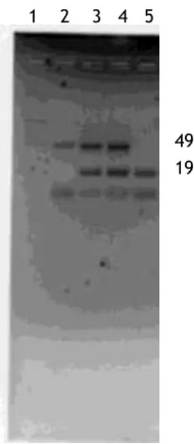 Figura  1.5  -  Eletroforese  em  gel  de  agarose  a  2%  GreenSafe.  1)  Marcador;  2)  Amostra  de  um  doente  homozigótico para a inserção (II); 3 e 4) Amostras de doentes heterozigóticos (ID); 5) Amostra de doente  homozigótico para a deleção (DD)