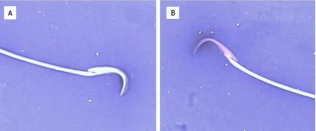 Figure 10 -  Light microscopy image of a typical rat spermatozoon. Viable rat spermatozoon (A) and  non-viable rat spermatozoon (B) stained with Eosin/Negrosin (1000× magnification)