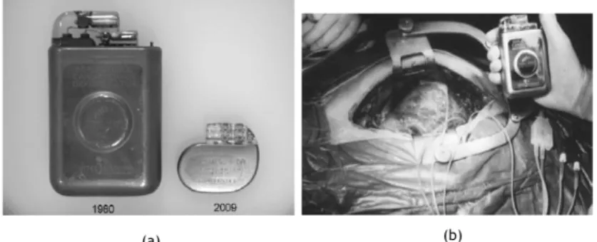Fig.  7  –  Painel  (a):  Exemplo  de  um  dos  primeiros  Desfibrilhadores  Automáticos  Implantáveis  (à  esquerda),  em  comparação  com  Cardioversor-Desfibrilhador  Implantável  com  programação  de  duas  câmaras    (à  direita);  Painel  (b):  Impla