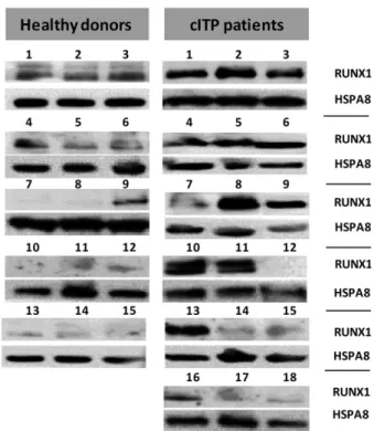 Fig 4. Protein expression of RUNX3 in platelets of cITP patients (n = 14) versus healthy controls (n = 8) were analysed using Western blot assays (ACTB as loading control)