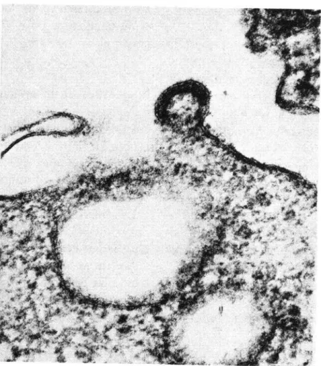 FIGURA  2-Micrografía  electrónica  de  una  particula  de  VLB,  desprendihdote  de  la  membrana  celular  (X  140,000)