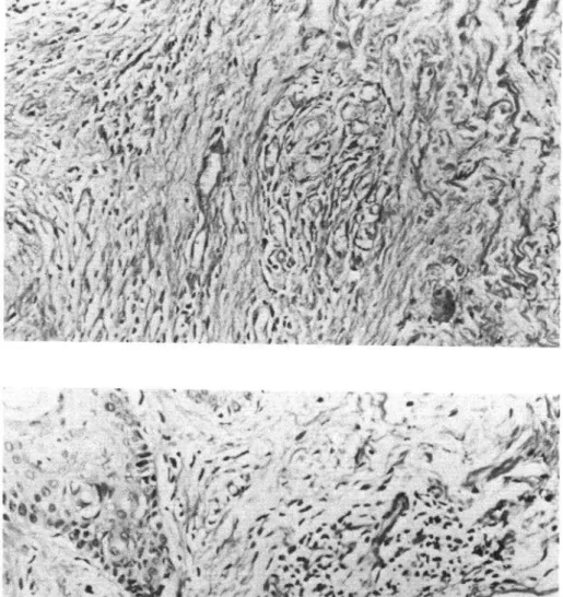 Figure  9.  (A)  Biopsy  5347: 