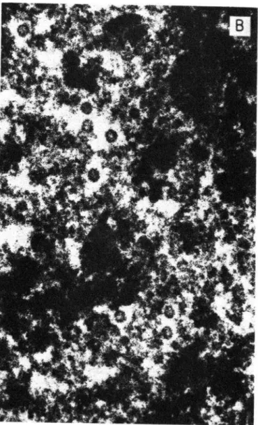 FIGURA  4-(A)  Partículas  de  virus  de  hepatitis  A  en  el  citoplasma  de  un  hepatocito  procedente  de  un  tití  infectado  con  virus  CR326