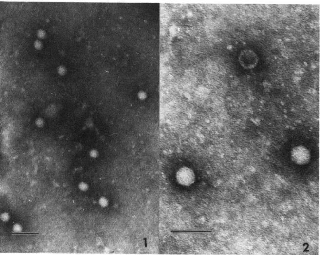 TABLE  3-Antibody  responses of  paired  sera from  44  Costa  Rican  hepatitis  cases to  CR69  (076)