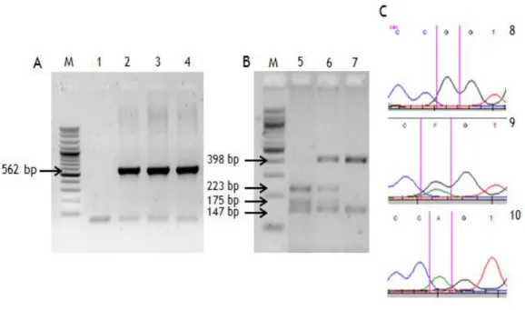 Figure  5  –  Genotyping  results  for  the  G691S  polymorphism.  A:  1%  Agarose  gel  electrophoresis  of  PCR  products  containing  exon  11;  1  –  negative  control,  2  to  4  bands  of  562  bp  representing  exon  11  PCR  amplification