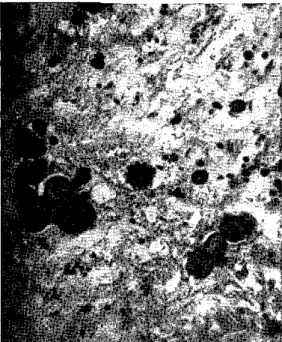 Figure  7.  Giant  and  dwarf  celis of P. Brasiliensis. Steering- Steering-wheel  form  in  center  of  the  field