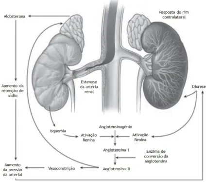 Figura II – Mecanismo de hipertensão arterial na estenose da artéria renal unilateral (24,26)