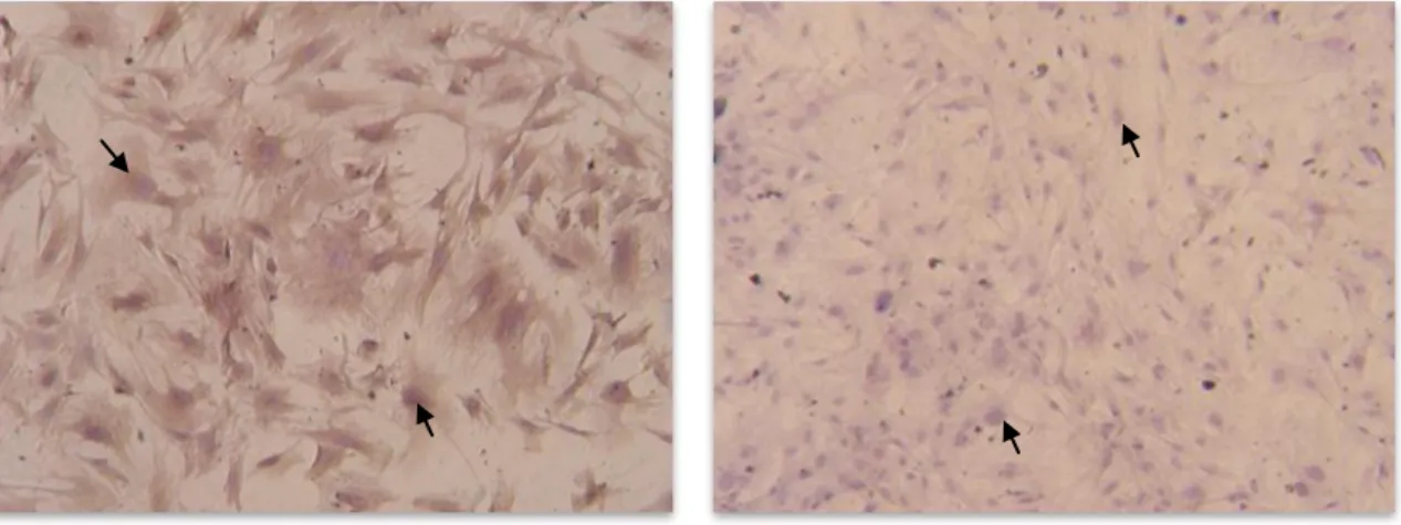 Figure 8:  Immunocytochemical staining for vimentin in rat Sertoli cells. a) rat Sertoli  cells  with  round  nuclei  (arrows;  x10);  b)  negative  control:  nuclei  stained  with  hematoxylin-eosin (arrows; x10)
