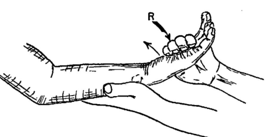 Figura  19.  Pruebas musculares  para la  flexión  de  la  muñeca.