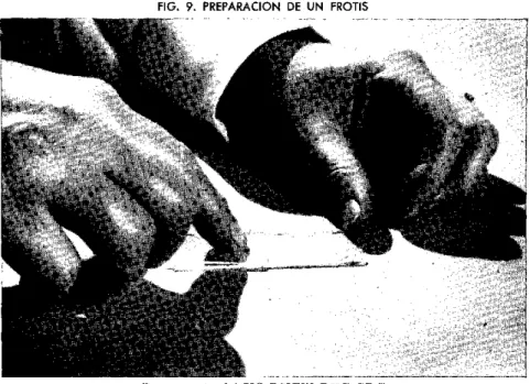 FIG.  9.  PREPARACION  DE  UN  FROTIS