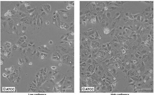 Figure 7. Caco 2 cells morphology under an optical microscope (scale bar = 100 μm, adapted from [71])