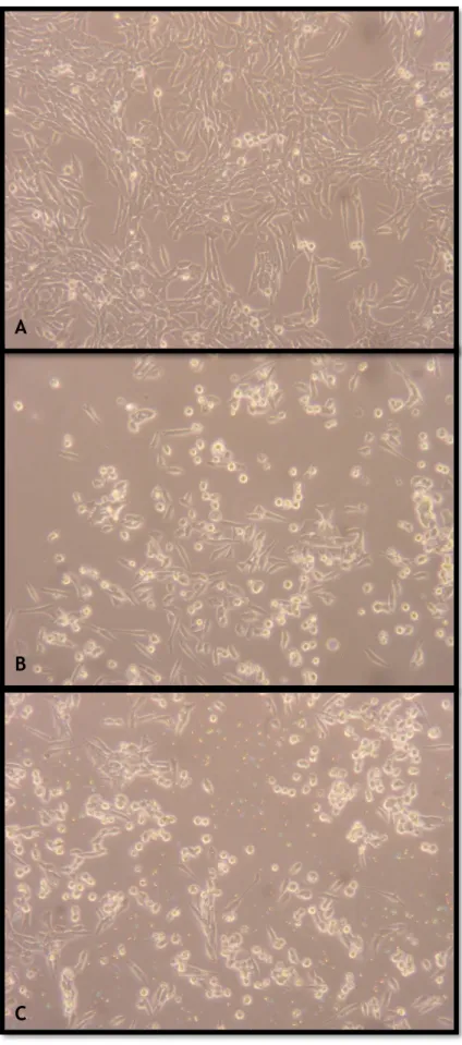Figure 5 - Morphology of N27 cells after 24 hours of treatment; A -  cells not treated (control); B - cells treated with compound B1; C -  cells treated with compound B6