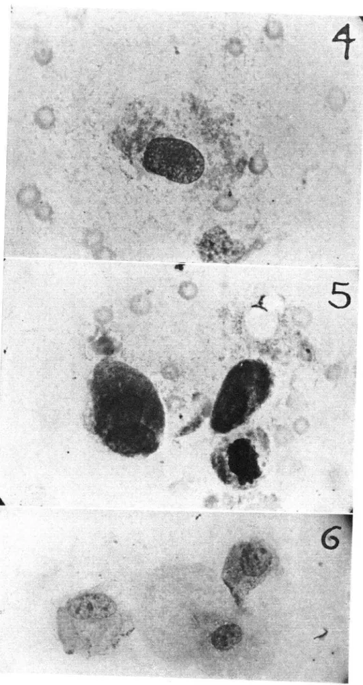 Fig.  4.-Virus  de  pulgas  de  ratas  de  la  E.  E.  de E.  E.  1 aginal  de rata  irradiada  14.g.l);  (iicmsa;  670  aumentos