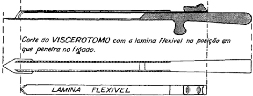 FIGURA  l.-Reproducáo  do  viscerotomo. 