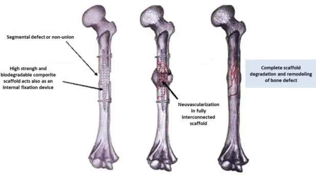 Figure 4: Schematic representation of the role of a scaffold in bone regeneration (adapted from [30])