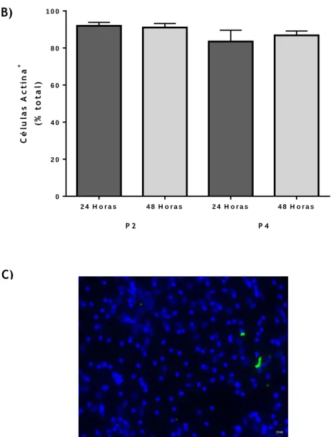 Figura  9.  Caracterização  e  avaliação  da  pureza  da  cultura  primária  de  SMC.  A  -  Imagem  representativa de uma imunocitoquímica em que as SMC foram marcadas com anti-α-actina (verde)