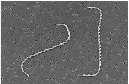 Figura 1- Fotografia de microscopia eletrónica de Leptospira (adaptado de  https://pt.wikipedia.org/wiki/Leptospira_interrogans)