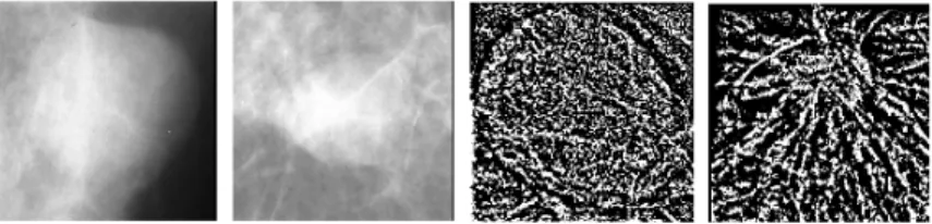 Fig. 2. Examples of 150×150 crop images. On the left two images without normalization and on the right images with normalization.