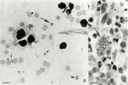 Figura 2 - Taquizoítos de  T. gondii. A: Lâmina de tecido do pulmão, onde podemos observar  taquizoítos  isolados  (setas  pequenas),  binucleadas  (setas  grandes)  e  em  fase  de  divisão  e  multiplicação (Pontas de setas); B: secção de um nódulo linfá