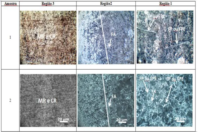 Figura 5: Microestruturas reveladas das três (3) peças retiradas do virabrequim, tratadas termicamente: Região 1 –  metal de base  (MB) que não sofreu o tratamento térmico; Região 2 -  transição entre o MB e a região tratada  termicamente; Região 3 – trata