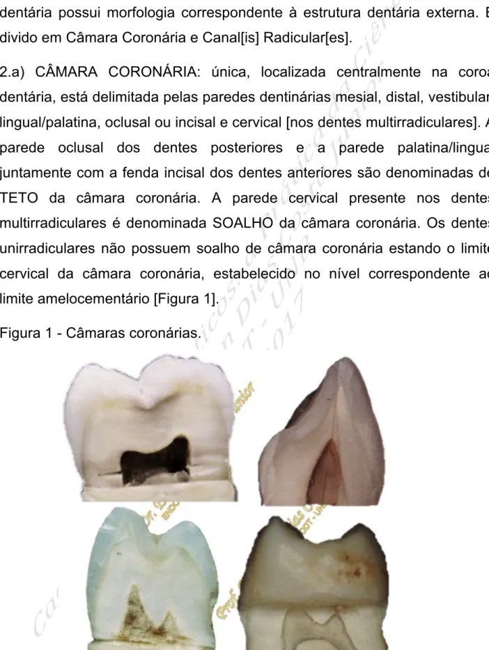 Figura 1 - Câmaras coronárias. 