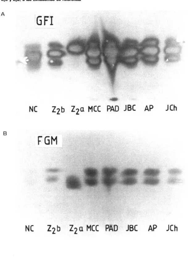 FIGURA 2. Dos ejemplos de zimogramas m  en acetato de celulosa. En el zimograma  A, b  enzima empleada fue glucosafosfato-isomerasa  (GFI) y en el B, fosfoglucomutase