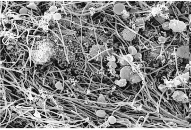 Figura 7. Biofilme bacteriano com diferentes morfologias celulares ampliação de 3500x (Adaptado  de Siqueira 2011)