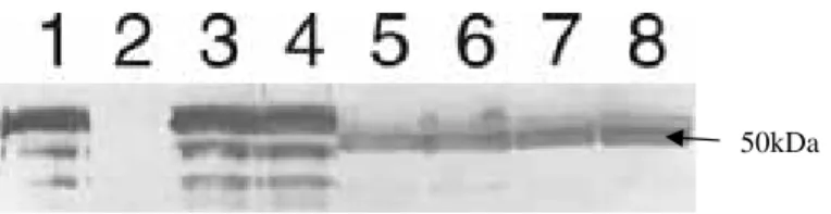 Figure 3. Western blot do leite de fêmeas transgênicas expressando o gene fo FIX humano