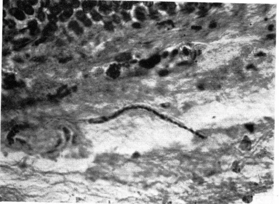 FIG.  ll.-Fragmento  de  microfilaria  en  substancia  propia,  ccrc!L  del  epitel  Xrnea) 