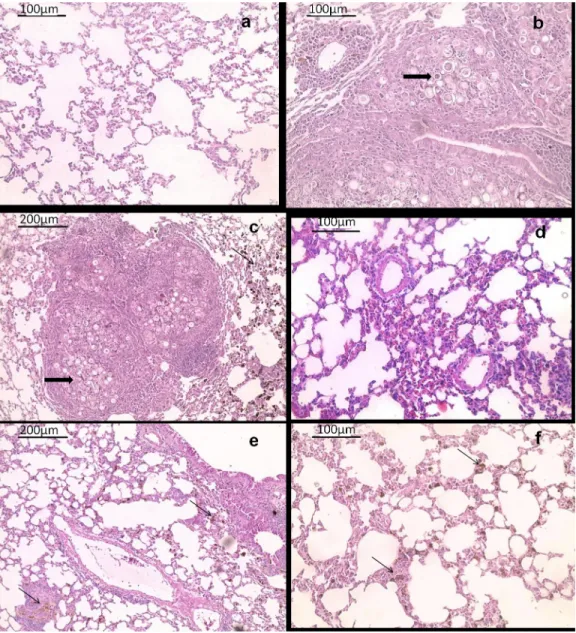 Fig 4. Histological appearance of female BALB/c mice lungs tissue hematoxylin and eosin-stained sections