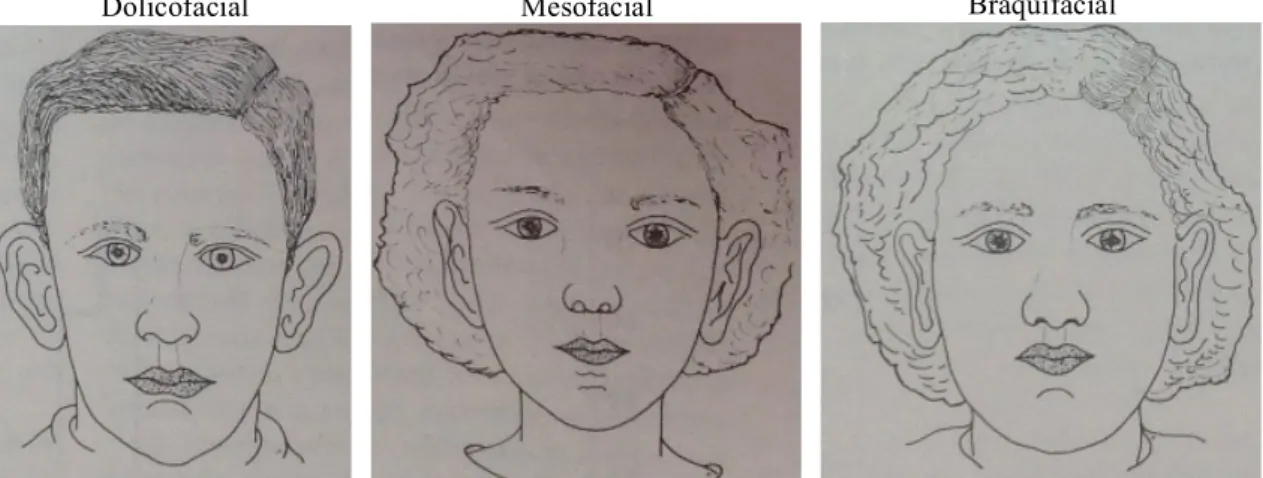 Figura 5 - Caracterização do Biótipo Facial. Graber, T. M. (1974)