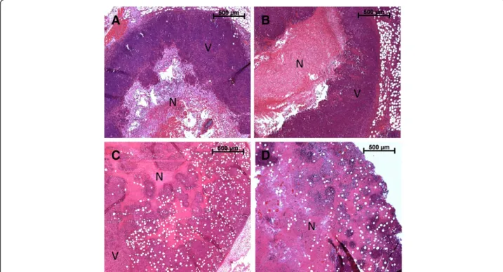 Figure 4 Ehrlich tumor histopathology after photodynamic therapy and doxorubicin treatment