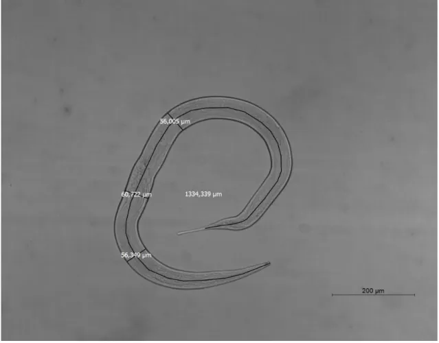 Figure 5 – Captured Microscopic Image showing nematode Length and Width measurements. Width  was measured at least in 3 different points to ensure that the maximum width of organism was identified