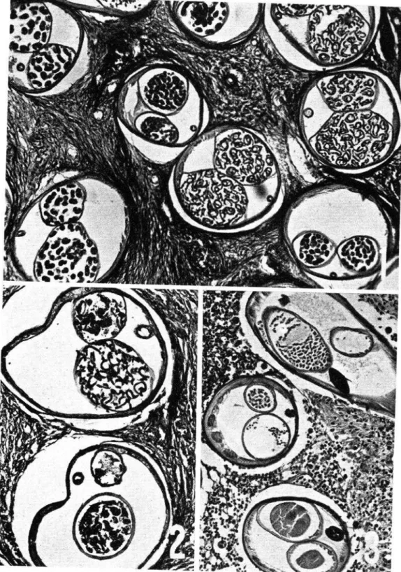 FIG.  2.-Essentially  normal  microfilaria  are  seen  in  one  cross  scction  of  uterus; 