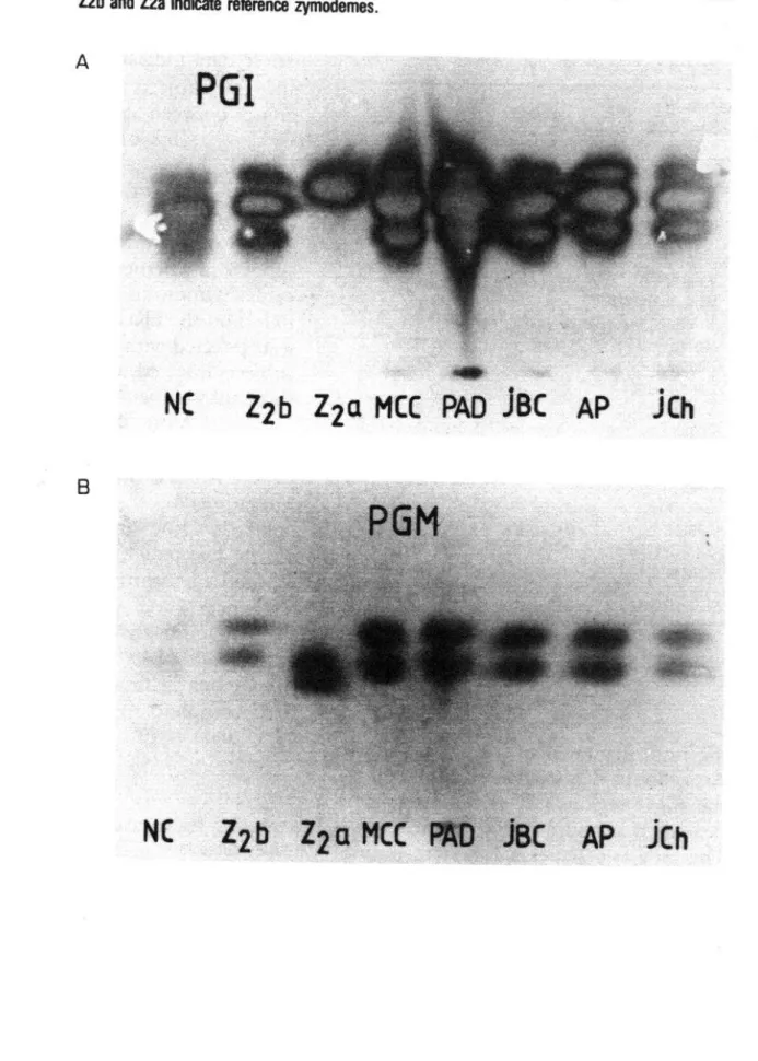 FIGURE  2.  Two examples of cellulose acdate ekctrophomtic zymograms. The enzyme employed in  (A) is phosphoglucoisomerase  (PGI), while that used in (B) is phosphoglucomutase  (PGM)