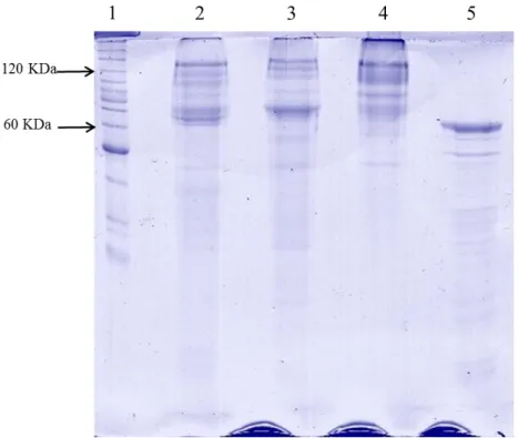 Figura  16.  Perfil  protéico  dos  cristais  solubilizados  contendo  as  toxinas  Cry  após  eletroforese  em  gel  de  acrilamida  12%