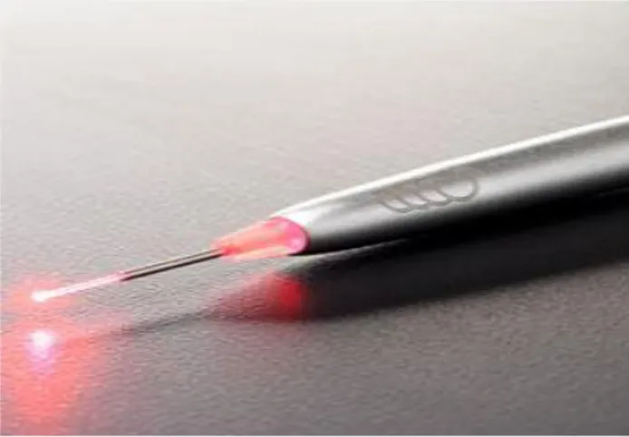 Figura  5:  Laser  para  remoção  de  braquetes  ([Consultado  em  07/05/2011] 