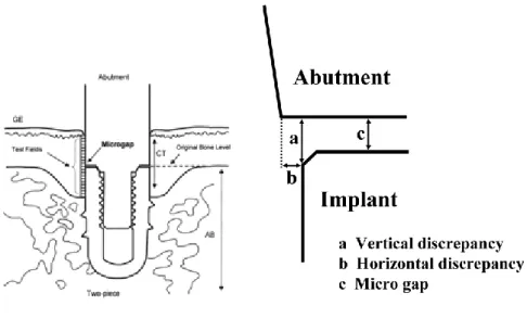 Figura 6: Microgap interface implante-pilar.(Ref.Google Images). 
