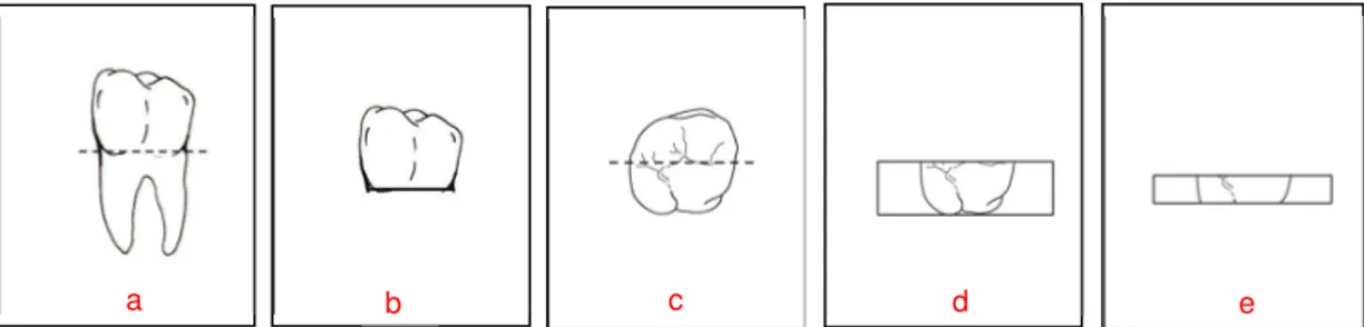 Figura 1: Preparo dos corpos de prova: (a) dente selecionado; (b) secção cervical; (c) secção  mésio-distal; (d) hemi-coroa incluída; (e) corpo de prova com 2mm de espessura.