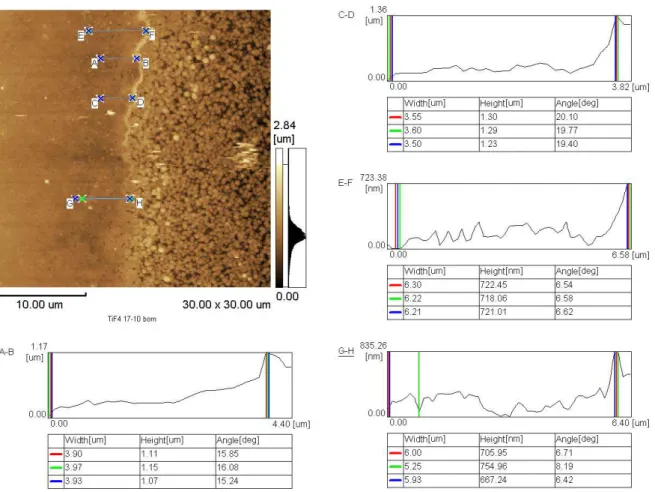 Figure 5 - AFM image of TiF 4  varnish group specimen with surface divided on side  with varnish application + erosive challenge and side without varnish application +  erosive  challenge