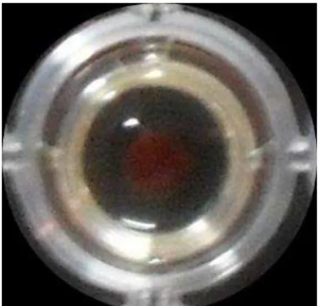 Figura  1:  Formação  de  aglomerado  de  célula  (“botão”)  no  interior  de  um  poço da microplaca  Figura  2:  Identificação  de microorganismos  viáveis  a partir da coloração avermelhada  após  adição  do TTC