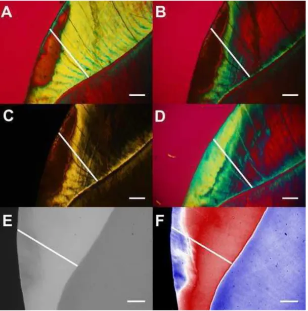 Fig.  1.  Typical  features  of  a  NEC  lesion  in  all  media  with  the  transversal  line  where  histological 