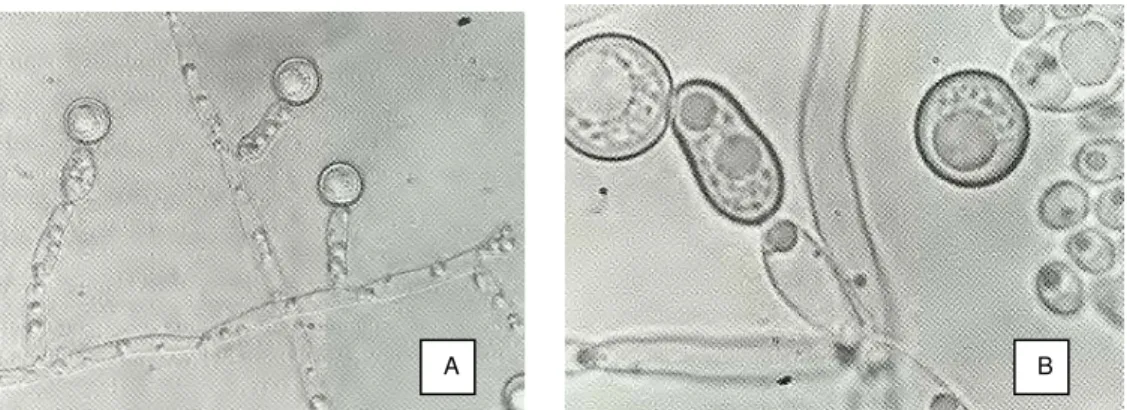 Figura 1. Cultivo de C. albicans. Clamidoconídios globosos no ápice das pseudo-hifas em A (400X) e  B (630X) Fonte: LACAZ et al., 2002