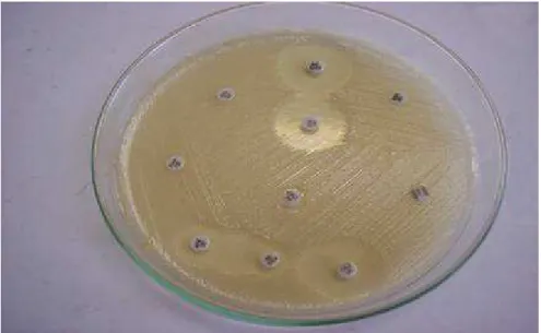 Figura 07 – Teste de ESBL positivo para E. coli