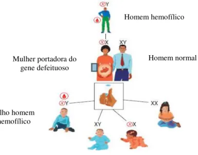 Figura  2  –  Herança  da  hemofilia:  (x)  =  gene  portando  o  defeito  genético  para  hemofilia;  =  Hemofílico 