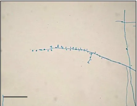 FIGURA 1. Estruturas microscópicas T. rubrum ATCC 1683,  com  a  presença  de  microconídios  em  forma  de  gota  dispostos ao logo do conidióforo (400x)