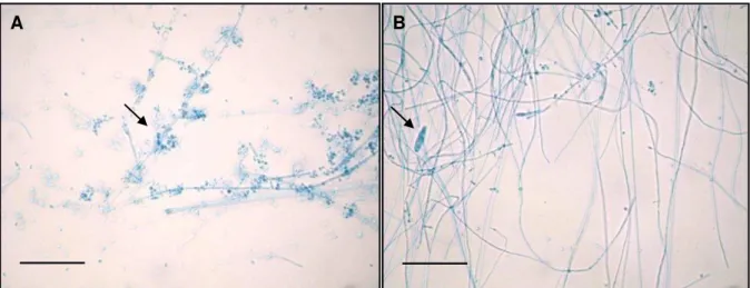 FIGURA  2.  Estruturas microscópicas  de  T. mentagrophytes  LM02  (400x),  com  a  presença  de microconídios agrupados em torno dos conidióforos (A) e macroconídios charutoides com  poucos septos (B)