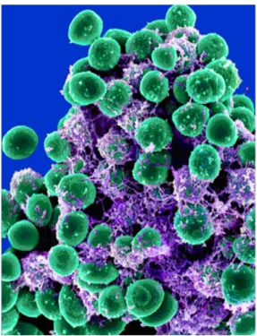 Figura 1 - Staphylococcus epidermidis.  [66]